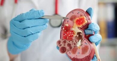 किडनी स्टोन को नजरअंदाज करना पड़ सकता है भारी, समय पर इलाज जरूरी